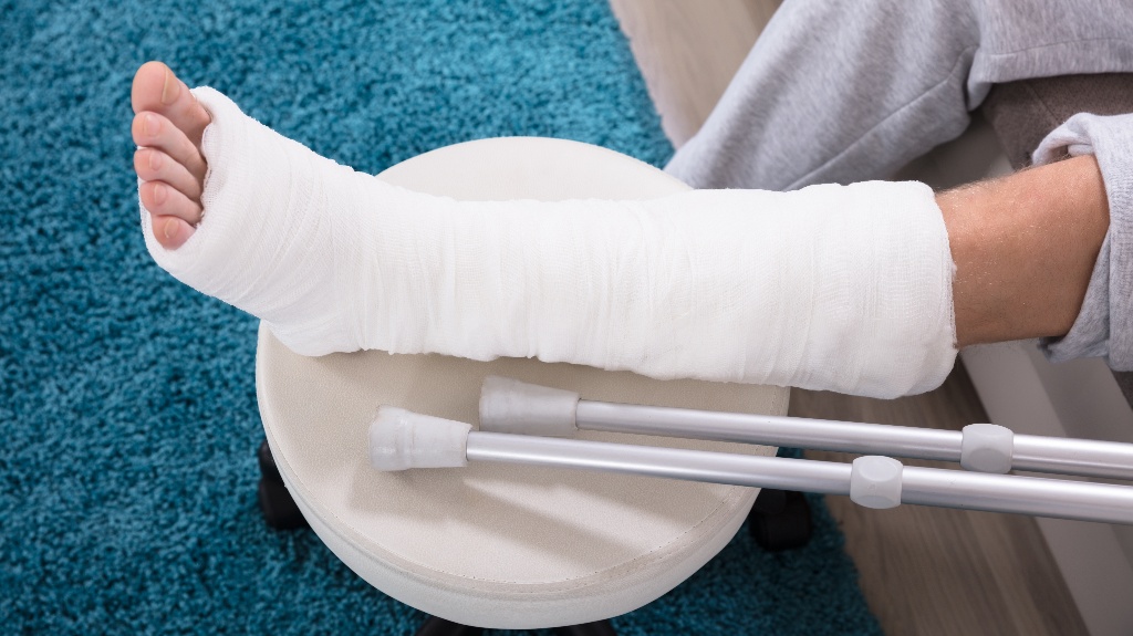 man's leg in a cast